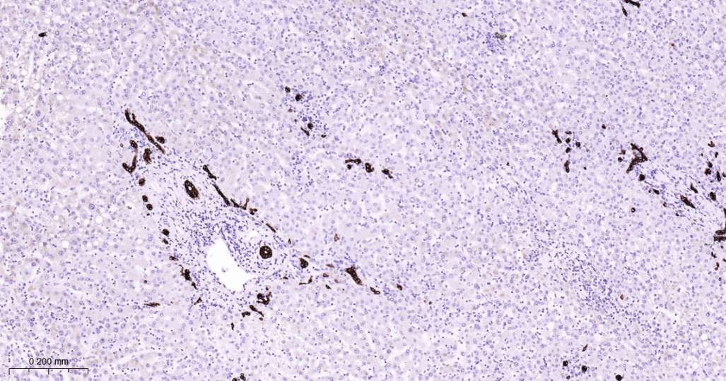 人Keratin 7即用型免疫组化试剂盒-IHC0604H